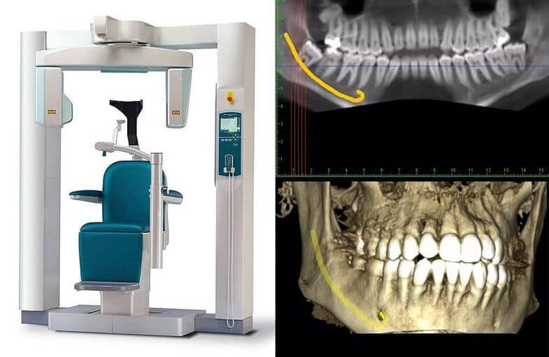 Los Angeles Orthodontics